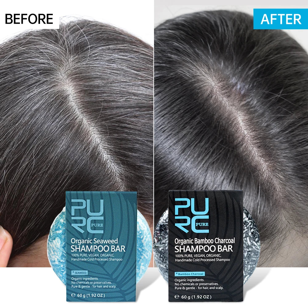 Solid Shampoo Bar for Hair Growth Anti-Dandruff Hair Loss Moisturizing Soothing Cleansing Darkening Hair Care Vegan Shampoo Soap - TotallyVeG