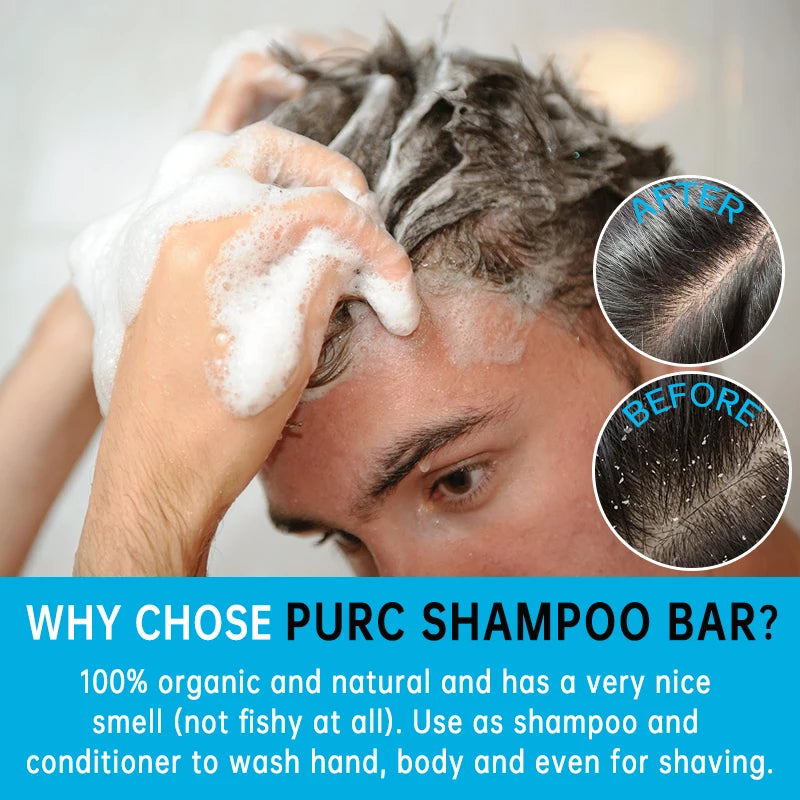 Solid Shampoo Bar for Hair Growth Anti-Dandruff Hair Loss Moisturizing Soothing Cleansing Darkening Hair Care Vegan Shampoo Soap - TotallyVeG